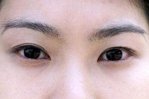 毛穴の黒ずみはエステサロンで解消しよう